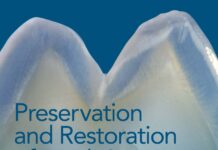 Preservation and Restoration of Tooth Structure (2016) Graham J. Mount