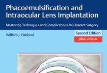 Phacoemulsification and Intraocular Lens Implantation – Mastering Techniques and Complications in Cataract Surgery (2017) William J. Fishkind
