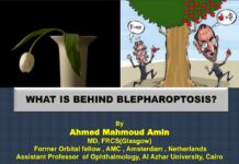 BLEPHAROPTOSIS – Clinical Assessment and Measurement Techniques (2020) Ahmed Mahmoud Amin