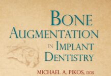 Bone Augmentation in Implant Dentistry – A Step-by-Step Guide to Predictable Alveolar Ridge and Sinus Grafting (2019) Michael A. Pikos