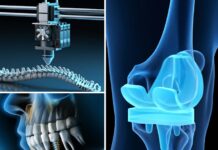 Biomedical Implants – Materials, Design, and Manufacturing (2024) Ravi K. Dwivedi