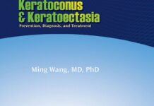 Keratoconus and Keratoectasia – Prevention, Diagnosis, and Treatment (2023) Multiple Authors