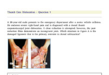 OrthoBullets MCQs – Pathology and Clinical Questions (2025) OrthoBullets