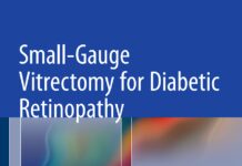 Small-Gauge Vitrectomy for Diabetic Retinopathy (2015) Ulrich Spandau