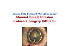 Manual Small Incision Cataract Surgery (MSICS) – Jaypee Gold Standard Mini Atlas Series () Ashok Garg
