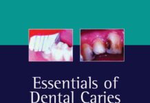 Essentials of dental caries – The disease and its management (2005) Edwina Kidd
