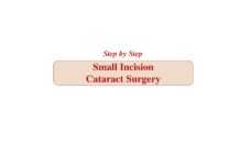 Step by Step Small Incision Cataract Surgery (2006) Anita Panda