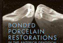 Bonded Porcelain Restorations in the Anterior Dentition – A Biomimetic Approach (2002) Pascal Magne