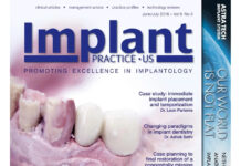 Implant Practice US – Promoting Excellence in Implantology (2016) Steve Barter
