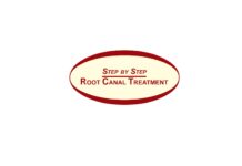 STEP BY STEP ROOT CANAL TREATMENT (2006) Vivek Hegde