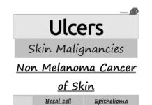 Ulcers and Skin Malignancies – Non-Melanoma Skin Cancer Basal Cell Epithelioma and Squamous Cell Carcinoma (2024) Yahia Makkeyah
