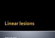 Linear Lesions – Clinical Features and Pathology of Skin Conditions Following Blaschko Lines (2023) Haitham M. Saleh