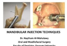 Mandibular Injection Techniques (2023) Dr. Haytham Al-Mahalawy