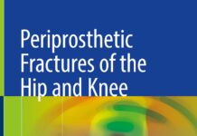 Periprosthetic Fractures of the Hip and Knee – Surgical Techniques and Tips (2019) Frank A. Liporace