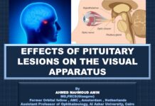 EFFECTS OF PITUITARY LESIONS ON THE VISUAL APPARATUS – THE TALE OF THE TWO EYES (2023) AHMED MAHMOUD AMIN