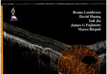 Clinical Guide to Angio-OCT – Non Invasive, Dyeless OCT Angiography (2015) Bruno Lumbroso