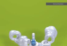 Straumann® Guided Surgery – Basic Information, Technical Information (2021) Straumann