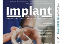 Implant PRACTICE US – PROMOTING EXCELLENCE IN IMPLANTOLOGY (2020) Steve Barter