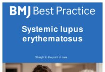 Systemic lupus erythematosus – Straight to the point of care (2023) BMJ Best Practice