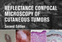 Reflectance Confocal Microscopy of Cutaneous Tumors (2017) Salvador González