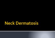Neck Dermatosis – Clinical Features and Differential Diagnosis (2024) Haitham M. Saleh