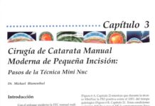 Cirugía de Catarata Manual Moderna – Técnicas de Pequeña Incisión (2005) Dr. Michael Blumenthal