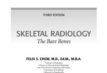 Skeletal Radiology – The Bare Bones (2010) Felix S. Chew