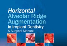 Horizontal Alveolar Ridge Augmentation in Implant Dentistry – A Surgical Manual (2016) Len Tolstunov