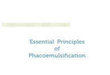 Essential Principles of Phacoemulsification (2013) Pascal W. Hasler, MD