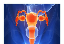 Gynecology – Notes by MedSN (2024) MedSN