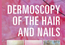Dermoscopy of the Hair and Nail (2016) Antonella Tosti