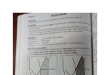 Anterior Abdominal Wall and Rectus Sheath – Part 2 (2024) Khanfour