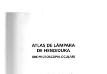 Atlas Lámpara de Hendidura – BiomicroscopĂa ClĂnica (2018) González, J. M.