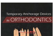 Temporary Anchorage Devices – IN ORTHODONTICS (2009) Ravindra Nanda