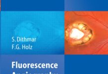 Fluorescence Angiography in Ophthalmology (2008) S. Dithmar