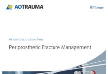 Periprosthetic Fracture Management (2014) Michael Schütz