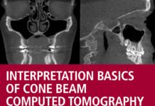 Interpretation Basics of Cone Beam Computed Tomography (2014) Shawneen M. Gonzalez