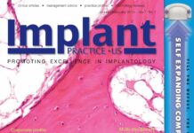 Promoting Excellence in Implantology – Clinical articles, management advice, practice profiles, technology reviews (2014) Steve Barter