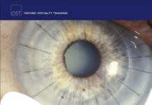 Training in Ophthalmology – Oxford Specialty Training (2009) Venki Sundaram