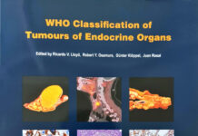 WHO Classification of Tumours of Endocrine Organs (2017) WHO Classification of Tumours Editorial Board