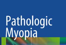 Pathologic Myopia (2014) Richard F. Spaide