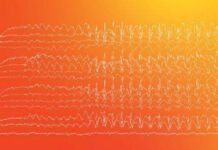 How to Read an EEG (2021) Neville M. Jadeja