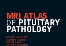 MRI Atlas of Pituitary Pathology (2015) Kevin M. Pantalone