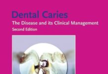 Dental Caries – The Disease and Its Clinical Management (2008) Ole Fejerskov