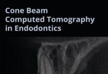 Cone Beam Computed Tomography in Endodontics (2016) Shanon Patel