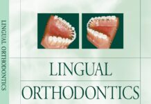 Lingual Orthodontics (2001) Rafi Romano