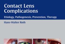 Contact Lens Complications – Etiology, Pathogenesis, Prevention, Therapy (2003) Hans-Walter Roth, M.D.
