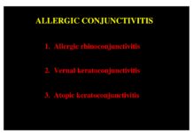 Allergic Conjunctivitis – Allergic Rhinoconjunctivitis, Vernal Keratoconjunctivitis, and Atopic Keratoconjunctivitis (2023) Unknown