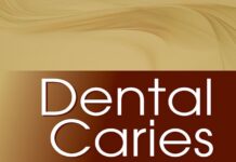 Dental Caries (2016) Vimal K Sikri